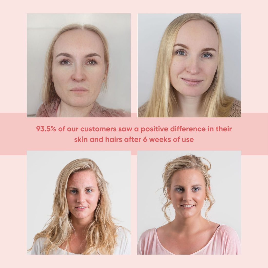 Marine Collagen